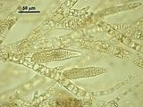 Ectocarpus fasciculatus4